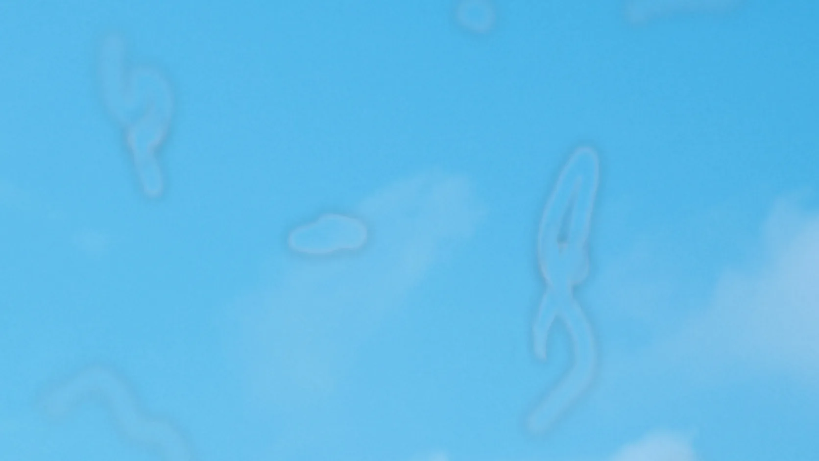 Simulation of translucent thread-like eye floaters drifting across a bright blue sky